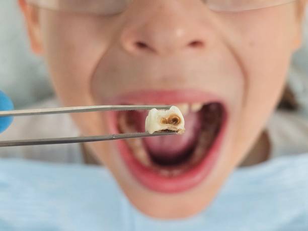 Best Pediatric Emergency Dentist in Homeland, CA